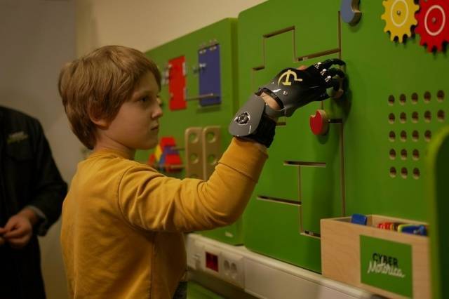 Резидент ОЭЗ «Технополис Москва» передал индивидуальный тяговый протез пальцев 10-летнему мальчику из Подмосковья